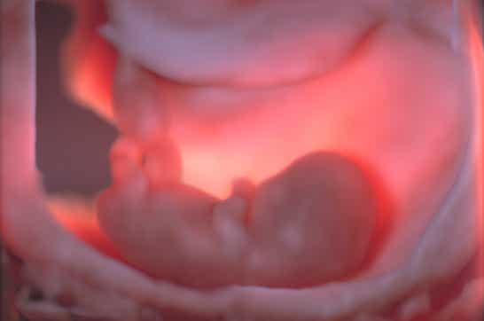Embryo und Amnionhöhle 12. SSW 3D