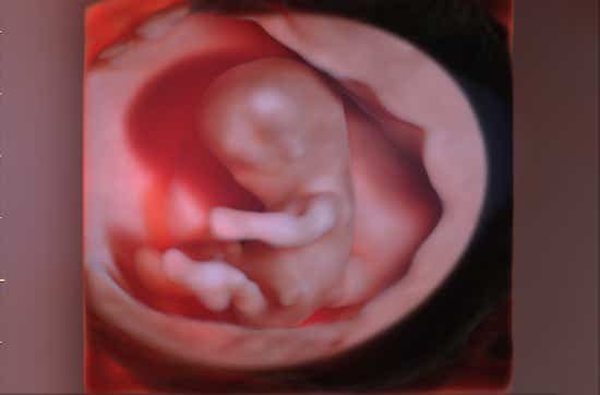 Embryo in der 12. SSW im 3-D Ultraschall