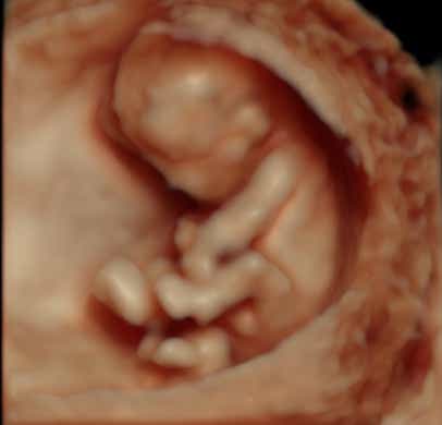 Embryo 12. SSW